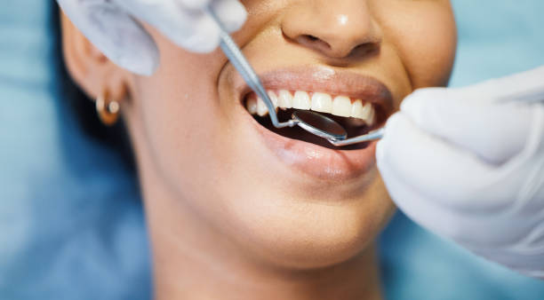 Best Emergency Treatment for Dental Infections or Abscesses in Severn, MD