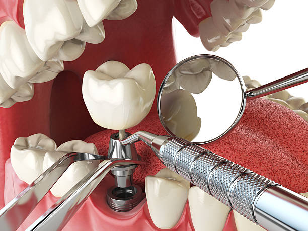 Best Cosmetic Emergency Dentistry in Severn, MD